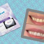 Are Crest Whitestrips with light worth it?