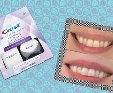 Are Crest Whitestrips with light worth it?